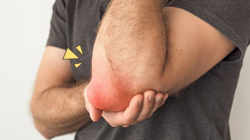 Diagram Kolsamat Arthritis